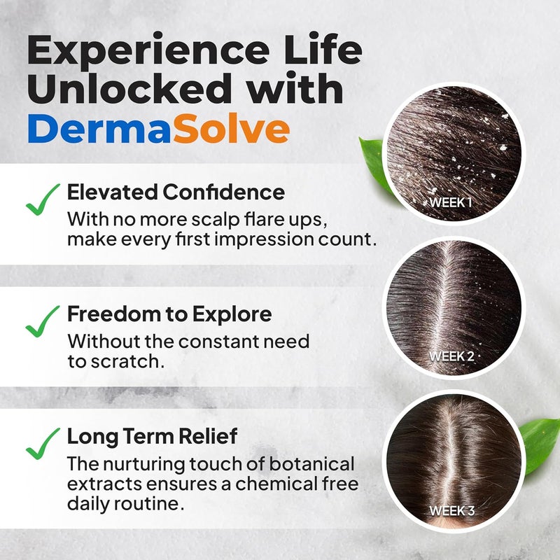 Dermasolve 4 oz Scalp Oil for Psoriasis, Seborrheic Dermatitis, and Dandruff - Dermatologist Approved Relief - Image 5